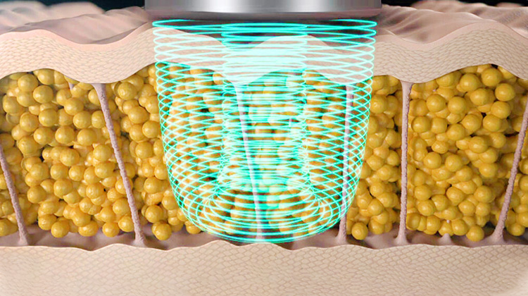 극초단파 에너지