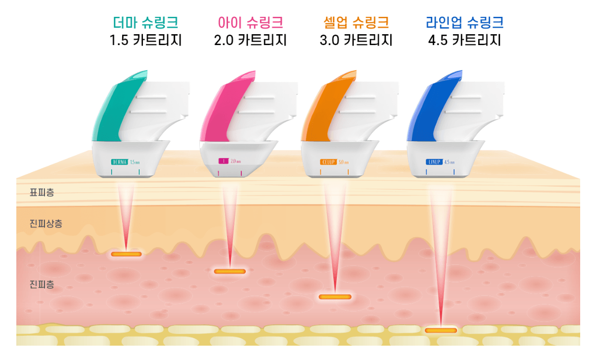 맞춤형 카트리지 